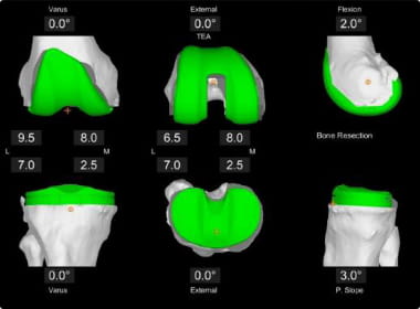 Robotics PPC - Straith Hospital - Latest-Techniques-Technology